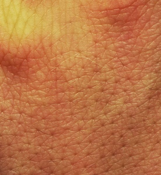 Menschliche Haut (Klafubra, CC BY-SA 3.0 , via Wikimedia Commons)